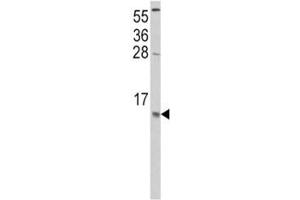 Western blot analysis of CCL2 antibody and HeLa lysate. (CCL2 antibody  (AA 62-89))