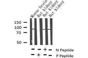 Western blot analysis of Phospho-Tau (Thr212) Antibody expression in mouse brain and rat kidney tissues lysates.