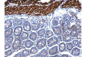 Immunohistochemistry (IHC) image for anti-Desmin (DES) antibody (ABIN2855655)