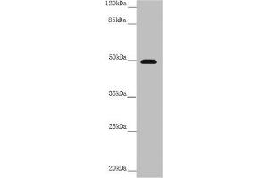 Western blot All lanes: PSTPIP1 antibody at 3. (PSTPIP1 antibody  (AA 157-416))