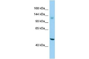 Host: Rabbit Target Name: GPR158 Sample Type: Jurkat Whole Cell lysates Antibody Dilution: 1. (GPR158 antibody  (C-Term))