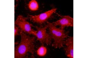 Immunofluorescence of human HeLa cells stained with monoclonal CLEC4E monoclonal antibody, clone AT16E3  (1 : 500) with Texas Red (Red). (CLEC4E antibody  (AA 41-219))