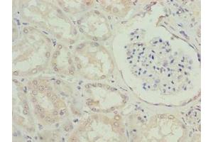 Immunohistochemistry of paraffin-embedded human kidney tissue using ABIN7151406 at dilution of 1:100 (EFCAB12 antibody  (AA 1-200))