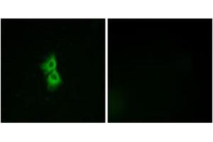 Immunofluorescence analysis of MCF7 cells, using GPR22 Antibody. (GPR22 antibody  (AA 271-320))