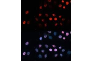 Immunofluorescence analysis of HeLa cells using TET1 Polyclonal Antibody (ABIN3022030, ABIN3022031, ABIN3022032, ABIN1513597 and ABIN6218576) at dilution of 1:100 (40x lens). (TET1 antibody)