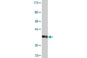 Western Blot detection against Immunogen (36. (LRRC2 antibody  (AA 272-371))