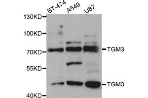 Western blot analysis of extracts of various cell lines, using TGM3 antibody. (TGM3 antibody)