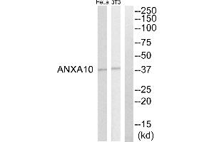 Western blot analysis of extracts from HeLa cell and NIH-3T3 cells, using ANXA10 antibody. (Annexin a10 antibody)