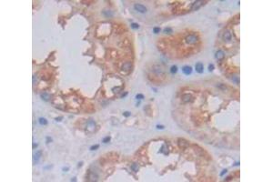 Used in DAB staining on fromalin fixed paraffin- embedded Kidney tissue (OCEL1 antibody  (AA 1-109))