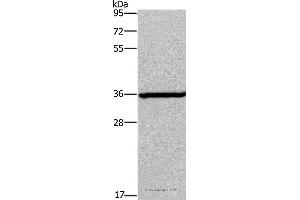 Western blot analysis of Mouse brain tissue, using DIO2 Polyclonal Antibody at dilution of 1:200 (DIO2 antibody)
