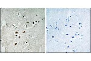 Immunohistochemistry analysis of paraffin-embedded human brain, using Elk3 (Phospho-Ser357) Antibody. (ELK3 antibody  (pSer357))