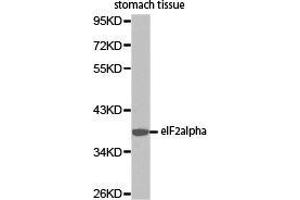 Western Blotting (WB) image for anti-Eukaryotic Translation Initiation Factor 2 Subunit 1 (EIF2S1) antibody (ABIN2650910) (EIF2S1 antibody)