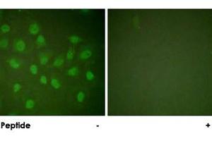 Immunofluorescence analysis of HeLa cells, treated with PMA (125 ng/mL, 30 mins), using POLR2A polyclonal antibody . (POLR2A/RPB1 antibody)