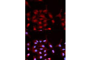 Immunofluorescence analysis of MCF-7 cells using Phospho-ABL1-Y245 antibody (ABIN5969865). (ABL1 antibody  (pTyr245))