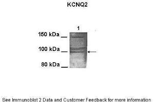 Lanes:   100 ug CHO cell lysate  Primary Antibody Dilution:   1:1000  Secondary Antibody:   Goat anti-rabbit HRP  Secondary Antibody Dilution:   1:25000  Gene Name:   KCNQ2  Submitted by:   Anonymous (KCNQ2 antibody  (N-Term))