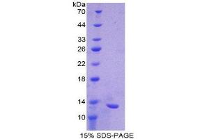 SDS-PAGE (SDS) image for Chemokine (C-X-C Motif) Ligand 11 (CXCL11) (AA 22-100) protein (His tag) (ABIN1878548)