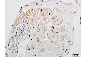 Formalin-fixed and paraffin embedded human myocardial tissue labeled with Anti-CT-1/CTF1 Polyclonal Antibody, Unconjugated (ABIN741675) followed by conjugation to the secondary antibody and DAPI (Cardiotrophin 1 antibody  (AA 121-201))