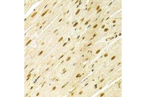 Immunohistochemistry (Paraffin-embedded Sections) (IHC (p)) image for anti-Mitogen-Activated Protein Kinase 3 (MAPK3) (AA 1-100) antibody (ABIN3020725)