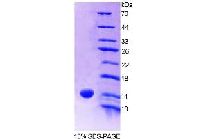 Image no. 1 for S100 Calcium Binding Protein A9 (S100A9) (AA 1-114) protein (His tag) (ABIN1080761) (S100A9 Protein (AA 1-114) (His tag))