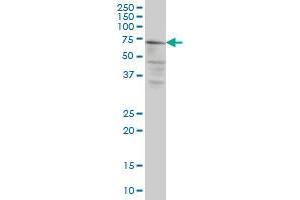 CAPN5 monoclonal antibody (M02A), clone 3C10 Western Blot analysis of CAPN5 expression in HeLa . (Calpain 5 antibody  (AA 523-622))