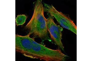 Immunofluorescence (IF) image for anti-delta-Like 1 Homolog (Drosophila) (DLK1) antibody (ABIN969086)