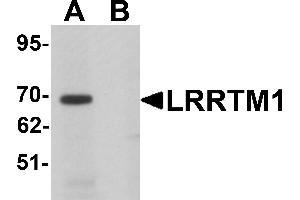 Western Blotting (WB) image for anti-Leucine Rich Repeat Transmembrane Neuronal 1 (LRRTM1) (C-Term) antibody (ABIN1030496)
