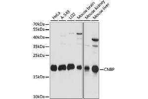 Western blot analysis of extracts of various cell lines, using CNBP antibody (ABIN7266165) at 1:1000 dilution. (CNBP antibody  (C-Term))