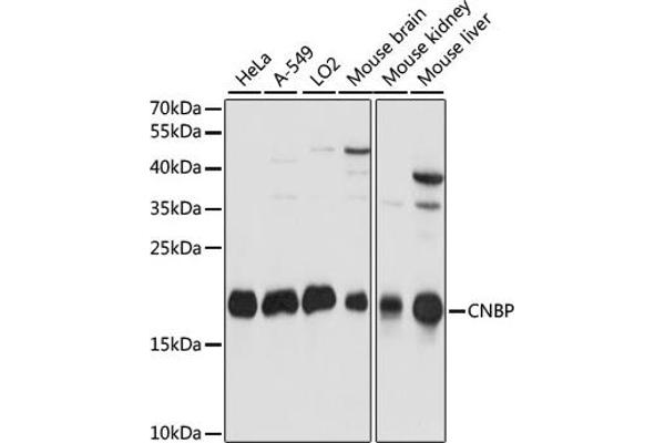 CNBP antibody  (C-Term)