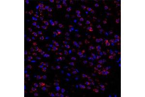 Immunofluorescent analysis of paraformaldehyde-fixed rat brain nigra using Torsin A (ABIN7075942) at dilution of 1: 3000 (TOR1A antibody)