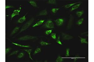 Immunofluorescence of monoclonal antibody to RGN on HeLa cell. (Regucalcin antibody  (AA 200-299))