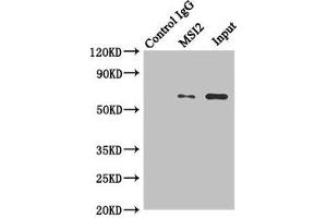 Immunoprecipitating MKS1 in Hela whole cell lysate Lane 1: Rabbit control IgG instead of (1 μg) instead of ABIN7159091 in Hela whole cell lysate. (MKS1 antibody  (AA 150-300))