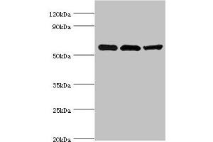 Western blot All lanes: Aldehyde dehydrogenase X, mitochondrial antibody at 4 μg/mL Lane 1: Hela whole cell lysate Lane 2: Rat brain tissue Lane 3: HepG2 whole cell lysate Secondary Goat polyclonal to rabbit IgG at 1/10000 dilution Predicted band size: 57 kDa Observed band size: 57 kDa (ALDH1B1 antibody  (AA 278-517))
