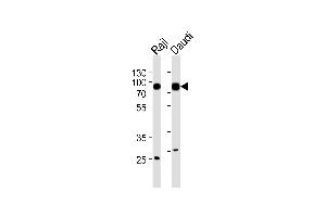 Western blot analysis of lysates from RajI,Daudi cell line (from left to right),using HS1 Antibody (Ab-397) .