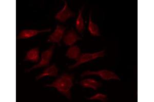 ABIN6267370 staining HepG2 by IF/ICC. (FGFR1 antibody  (pTyr154))