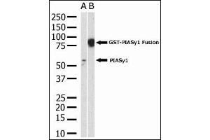 The anti-PIASy polyclonal antibody (ABIN388061 and ABIN2845720) is used in Western blot to detect PIASy in HL-60 cell lysate. (PIAS4 antibody  (N-Term))