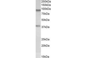 Western Blotting (WB) image for anti-Amine Oxidase, Copper Containing 3 (Vascular Adhesion Protein 1) (AOC3) (Internal Region) antibody (ABIN1449462) (AOC3 antibody  (Internal Region))