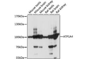 Western blot analysis of extracts of various cell lines, using ATP1A4 antibody (ABIN6292469) at 1:1000 dilution.