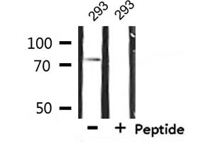 Western blot analysis of extracts from 293, using IL-2Rbeta/CD122 Antibody. (IL2 Receptor beta antibody  (Internal Region))