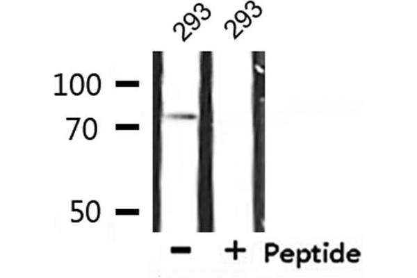 IL2 Receptor beta antibody  (Internal Region)