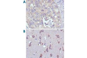 Immunohistochemical analysis of paraffin-embedded human lung cancer (A) and human brain (B) tissues using RPS27 monoclonal antibody, clone 4A12  with DAB staining. (RPS27 antibody)