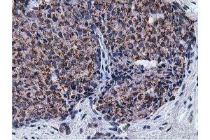 Immunohistochemical staining of paraffin-embedded Human liver tissue using anti-NT5DC1 mouse monoclonal antibody.