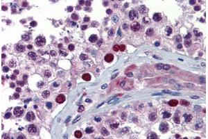 Human Testis (formalin-fixed, paraffin-embedded) stained with NFX1 antibody ABIN462262 followed by biotinylated goat anti-rabbit IgG secondary antibody ABIN481713, alkaline phosphatase-streptavidin and chromogen. (NFX1 antibody  (C-Term))