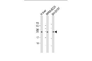 All lanes : Anti-NT5M Antibody (C-Term) at 1:2000 dilution Lane 1: human liver lysate Lane 2: RI-8226 whole cell lysate Lane 3: SH-SY5Y lysate Lysates/proteins at 20 μg per lane.