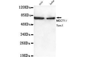 Western blot detection of MECT1 / Torc1 in Hela and Jurkat lysates using MECT1 / Torc1 mouse mAb (1:1000 diluted). (CRTC1 antibody)