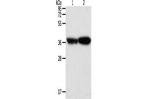 Western Blotting (WB) image for anti-Tropomyosin-2 (TPM2) antibody (ABIN2432365)