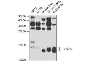 Western blot analysis of extracts of various cell lines, using HRSP12 antibody  at 1:1000 dilution. (HRSP12 antibody  (AA 1-137))