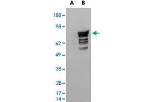 HEK293 overexpressing human PDE4D2 and probed with PDE4D polyclonal antibody  (mock transfection in first lane), tested by Origene. (PDE4D antibody  (C-Term))
