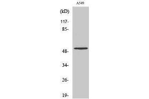 Western Blotting (WB) image for anti-Matrix Metallopeptidase 17 (Membrane-inserted) (MMP17) (cleaved), (Gln129) antibody (ABIN3181815)