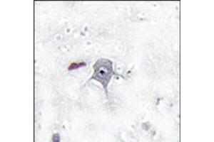 Image no. 1 for anti-Phosphoinositide 3 Kinase, p85 beta (PI3K p85b) (N-Term) antibody (ABIN360465) (PIK3R2 antibody  (N-Term))
