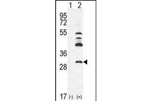 Western blot analysis of UCK2 (arrow) using rabbit polyclonal hUCK2- (ABIN391287 and ABIN2841329). (UCK2 antibody  (C-Term))
